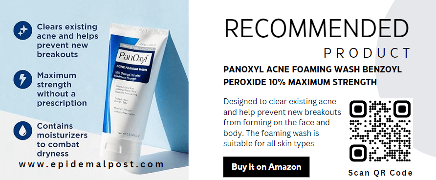 epidemalPost-PanOxyl Acne Foaming Wash